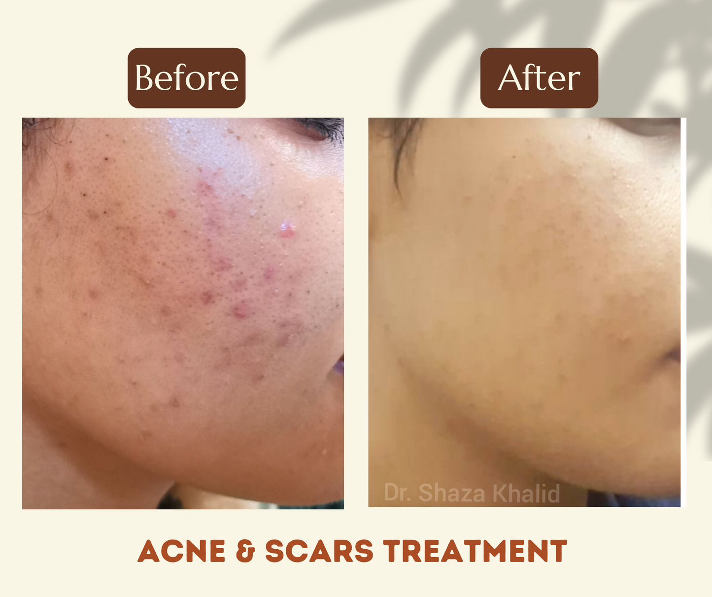 Organic A cream by Dr.Shaza Khalid التركيبة A