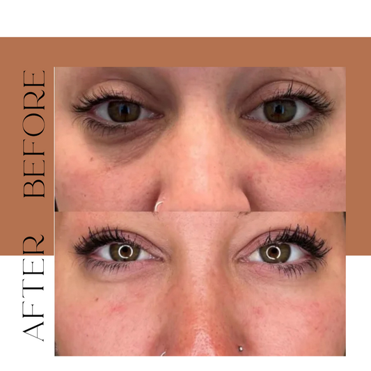 EYES BOOSTER
